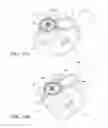 Fig. 35 - Patient support apparatus