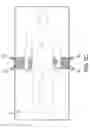 Fig. 11 - Patient transfer assembly