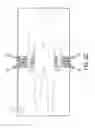 Fig. 11 - Patient transfer system