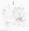 Fig. 19 - Methods of transferring patients