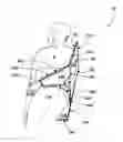 Fig. 01 - Left arm trans access positioning apparatus