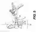 Fig. 06 - Device for Mitigating Motion Sickness and Other Responses to Inconsistent Sensory Information