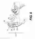 Fig. 07 - Device for Mitigating Motion Sickness and Other Responses to Inconsistent Sensory Information