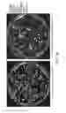 Fig. 28 - Compositions and methods for reducing cutaneous microbiome malodor
