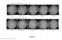 Fig. 07 - ACTIVES FOR STIMULATING DIFFERENTIATION OF KERATINOCYTES TO LIGHTEN HYPERPIGMENTED SKIN