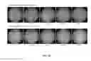Fig. 08 - ACTIVES FOR STIMULATING DIFFERENTIATION OF KERATINOCYTES TO LIGHTEN HYPERPIGMENTED SKIN