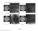 Fig. 10 - ACTIVES FOR STIMULATING DIFFERENTIATION OF KERATINOCYTES TO LIGHTEN HYPERPIGMENTED SKIN