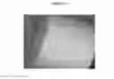 Fig. 08 - Dry powder vancomycin compositions and associated methods