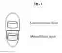 Fig. 02 - CAPSULE FORMULATION COMPRISING MONTELUKAST AND LEVOCETIRIZINE
