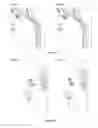 Fig. 03 - METHOD OF TREATMENT FOR BODY CONTOURING