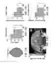 Fig. 11 - THERAPEUTIC TARGETING OF THE MTOR PATHWAY IN NEURODEVELOPMENTAL AND NEUROPSYCHIATRIC DISEASE