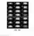 Fig. 17 - THERAPEUTIC TARGETING OF THE MTOR PATHWAY IN NEURODEVELOPMENTAL AND NEUROPSYCHIATRIC DISEASE