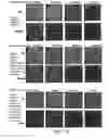 Fig. 22 - Compositions and methods for altering human cutaneous microbiome to increase growth of and reduce proliferation