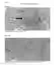 Fig. 37 - CORRELATES OF EFFICACY RELATING TO TUMOR VACCINES