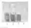 Fig. 01 - NON-HEMOLYZING BLOOD FILTER AND METHODS FOR FILTERING BLOOD WITHOUT HEMOLYSIS