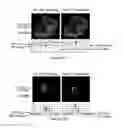 Fig. 08 - Inhibitors of NOX1