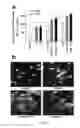 Fig. 05 - Elastin protective polyphenolics and methods of using the same