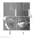 Fig. 07 - Treating liver diseases