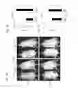 Fig. 02 - STEM CELLS FOR TRANSPLANTATION AND MANUFACTURING METHOD THEREFOR