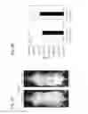 Fig. 03 - STEM CELLS FOR TRANSPLANTATION AND MANUFACTURING METHOD THEREFOR