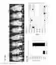 Fig. 04 - STEM CELLS FOR TRANSPLANTATION AND MANUFACTURING METHOD THEREFOR