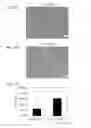Fig. 08 - STEM CELLS FOR TRANSPLANTATION AND MANUFACTURING METHOD THEREFOR