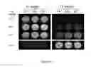 Fig. 14 - Self-assembled pharmaceutical composition for photodynamic therapy