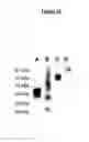 Fig. 14 - DERIVATISATION OF BIOLOGICAL MOLECULES