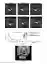 Fig. 11 - Gel formulations for guiding radiotherapy