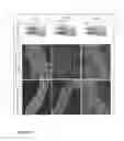 Fig. 16 - Polymer-tissue hybrid biomaterials and methods of making and using same