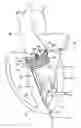 Fig. 01 - Catheter-based heart support system and method of implanting thereof