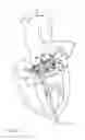 Fig. 03 - Catheter-based heart support system and method of implanting thereof