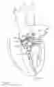 Fig. 04 - Catheter-based heart support system and method of implanting thereof