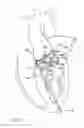 Fig. 05 - Catheter-based heart support system and method of implanting thereof
