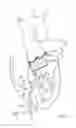 Fig. 06 - Catheter-based heart support system and method of implanting thereof