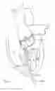 Fig. 07 - Catheter-based heart support system and method of implanting thereof