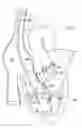 Fig. 08 - Catheter-based heart support system and method of implanting thereof