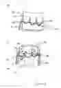 Fig. 13 - Catheter-based heart support system and method of implanting thereof