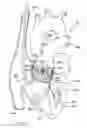 Fig. 20 - Catheter-based heart support system and method of implanting thereof