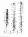Fig. 04 - CATHETER ASSEMBLY