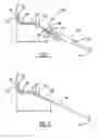 Fig. 02 - Wire guide for traversing body passages