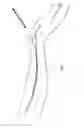 Fig. 07 - Method and device for sheathless arterial catheterization