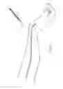 Fig. 12 - Method and device for sheathless arterial catheterization