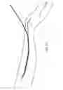Fig. 13 - Method and device for sheathless arterial catheterization