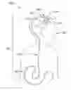 Fig. 01 - Method of using a catheter assembly