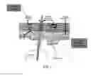 Fig. 02 - Microneedle roller (MNR) infusion system