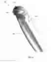 Fig. 05 - Microneedle roller (MNR) infusion system
