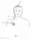 Fig. 02 - Lead, device and method for electrical stimulation of deep brain
