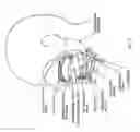 Fig. 141 - Obstructive sleep apnea treatment devices, systems and methods