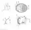 Fig. 156 - Obstructive sleep apnea treatment devices, systems and methods